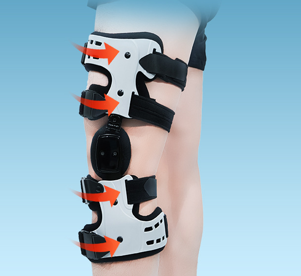 Three-Point Knee Orthosis with Adjustable Angle for O/X Legs